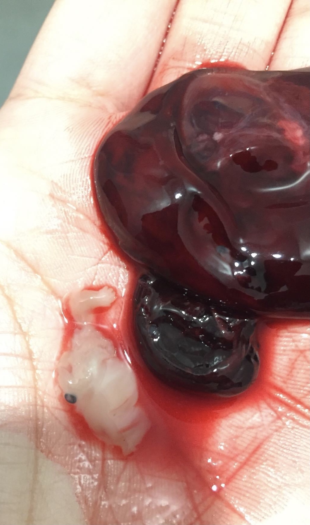 Ivf treatment — photo 1 of 1
