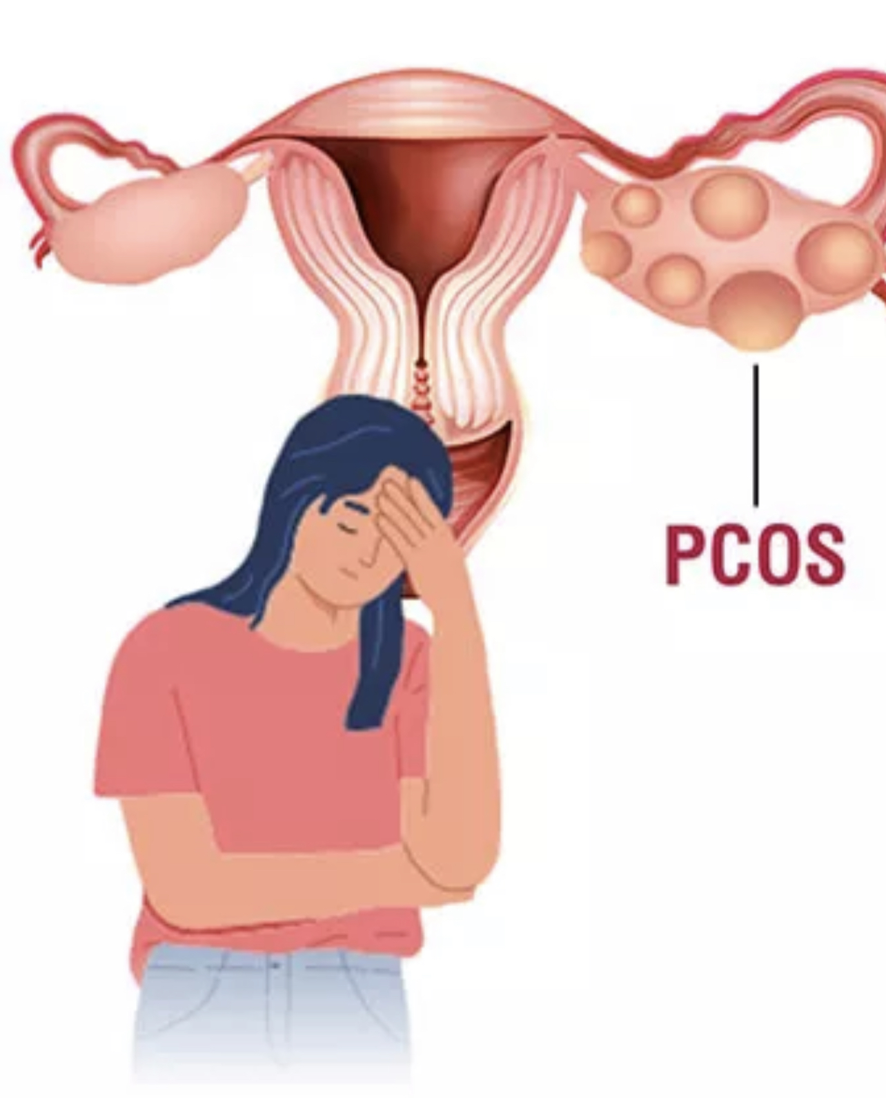 Funding IUI Procedure and Medication — photo 1 of 1