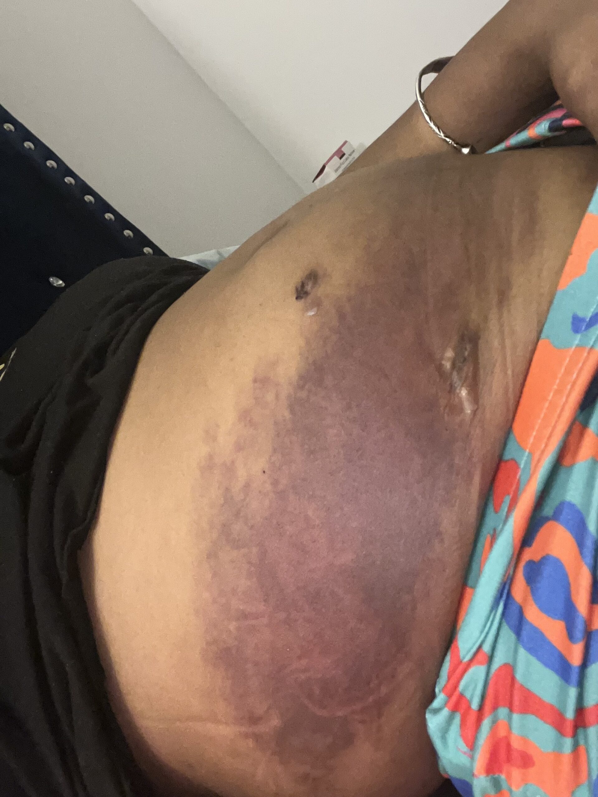 PLEASE HELP ME START MY FAMILY — photo 1 of 1